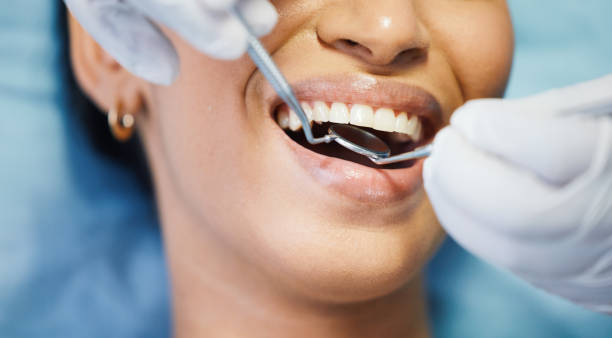 Best Emergency Tooth Extraction in Angleton, TX