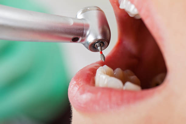 Best Walk-In Emergency Dentist in Angleton, TX